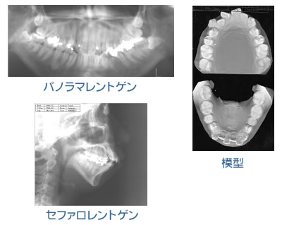 精密検査