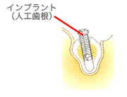 診査と治療計画