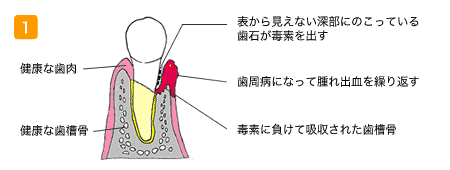 健康な歯槽骨